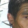 chaupham