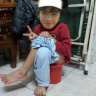 teo110i